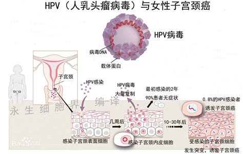 HPV是怎么感染的_百度知道