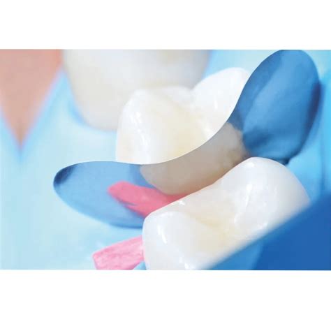 Buy Polydentia QuickmatFLEX Sectional Matrices – Oralkart