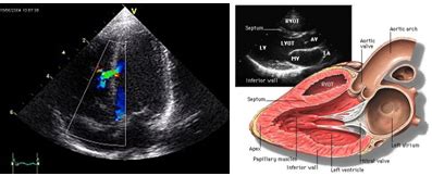 Chandan Diagnostic || TwoDEcho