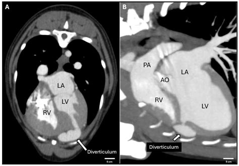 Advanced Imaging for Congenital Left Ventricular Diverticulum in a Dog ...