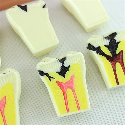 Buy XYXZ Anatomy Models Teeth Model For Educationdental Teeth Model ...