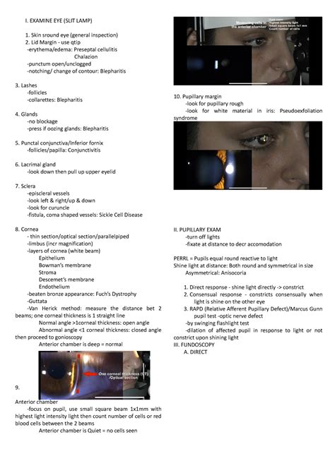 Image result for Slit Lamp Exam Tutorial