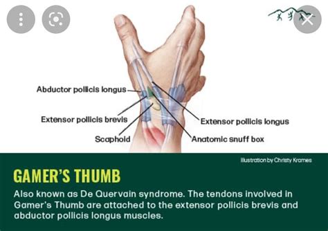 Image result for Extensor Retinaculum