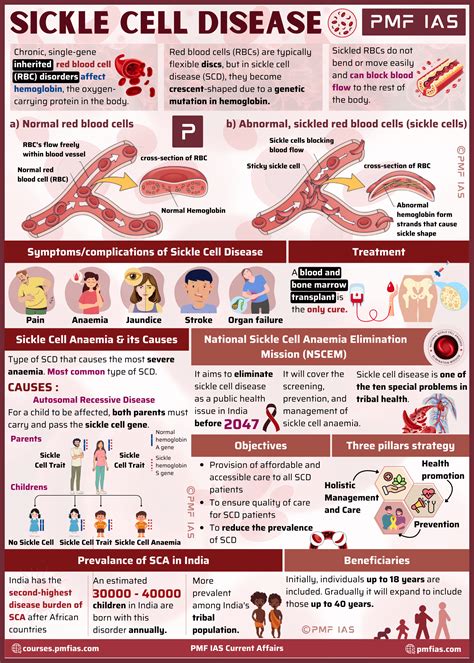 Sickle Cell