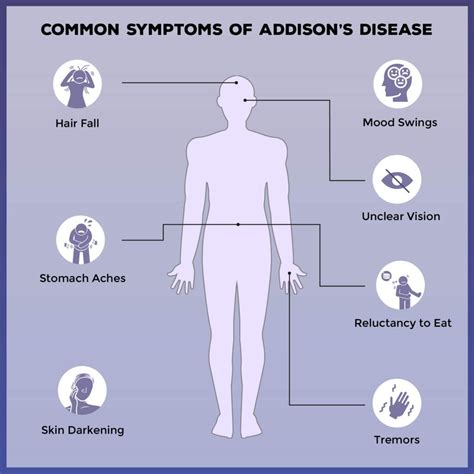 Best Addison S Disease Doctors at Jacob Shadforth blog