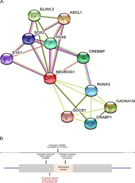 String Spring 的图像结果