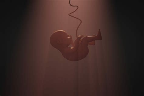 Marginal Cord Insertion: Possible Complications - Phillips Law Offices