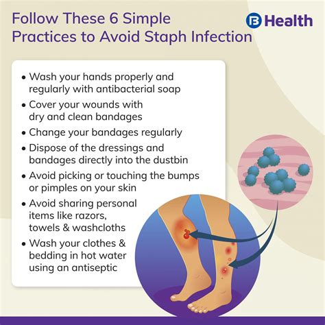 स्टाफ़ संक्रमण उपचार: जानने के लिए 4 महत्वपूर्ण बातें