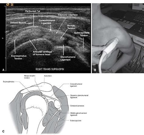 Rotator Cuff Interval