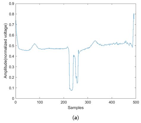 Structural Anomalies Detection from Electrocardiogram (ECG) with ...