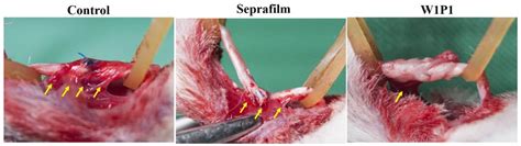 Electrospun Water-Borne Polyurethane Nanofibrous Membrane as a Barrier ...
