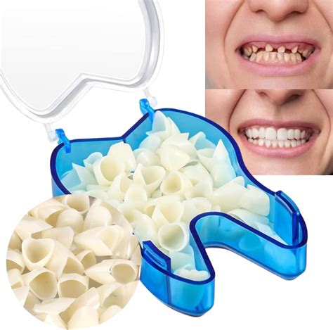 Tooth Repair Kit,50PCS Fake Teeth Temporary Tooth Replacement Kit ...