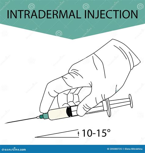 Intradermal And Subcutaneous Injection Vector Illustration | CartoonDealer.com #79997650