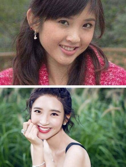 唐艺昕整容照曝光?看到照片后:难怪张若昀死心塌地爱她9年_网友