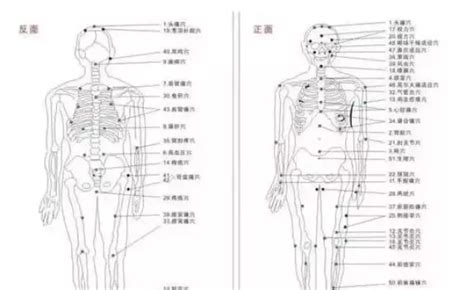 6項「耳朵習慣」等同自殘：挖耳朵、清耳屎當心造成耳道割傷 - 每日頭條