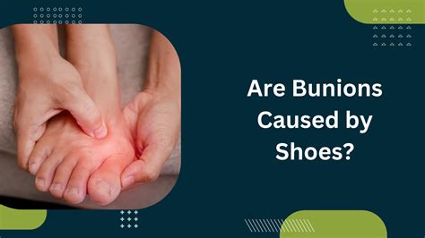 Are Bunions Caused by Shoes? - Dr KP Meda