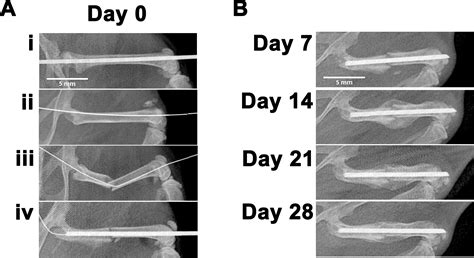 The Generation of Closed Femoral Fractures in Mice: A Model to Study Bone Healing