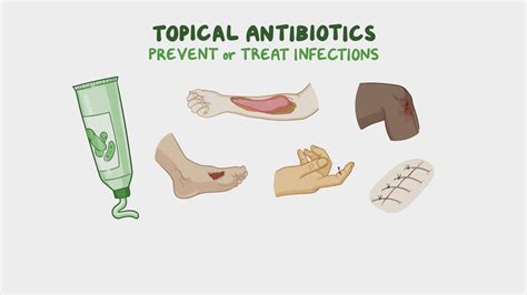 Topical Antibiotics