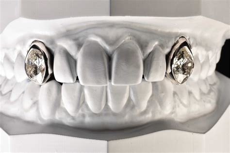 Post Malone drops $1.6M on diamond-studded smile