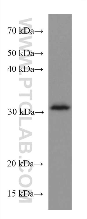 LACTB2 antibody (67399-1-Ig) | Proteintech