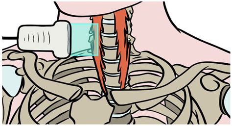 Testing the Reliability of a Procedure Using Shear-Wave Elastography ...