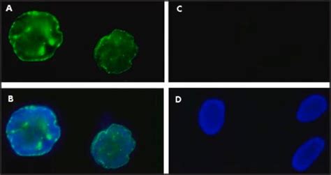 Anti-Green Fluorescent Protein (GFP) antibody, Mouse monoclonal clone ...