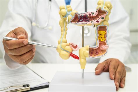 Image result for Colonoscopy Image System Component