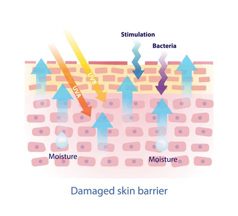 Signs Your Skin Barrier Is Damaged at Summer Hagenauer blog