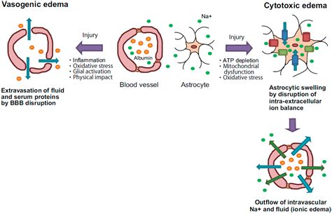 Pathogenesis of Brain Edema and Investigation into Anti-Edema Drugs