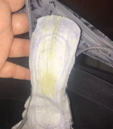 Brown, White, Yellow Odorless Discharge During Pregnancy: Should You Panic?