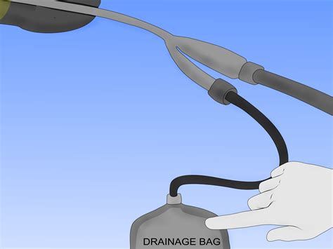 How To Insert A Catheter Video at Patricia Hart blog