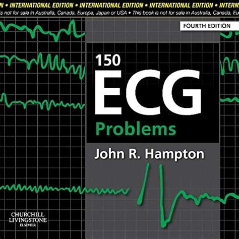 Buy 150 ECG Problems, International Edition Book Online at Low Prices ...