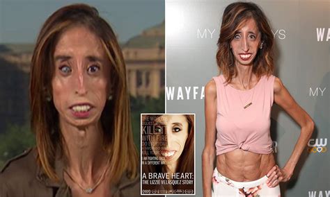 Worlds Ugliest Person How The World's 'Ugliest Man' Found True Love