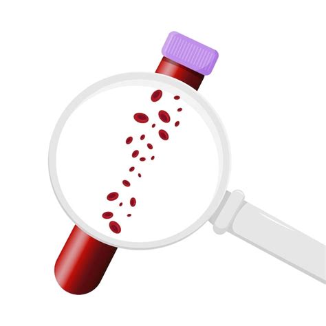 Platelet Count Blood Test: Understanding Normal, Low, and High Values ...