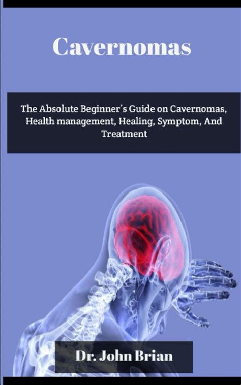 Buy Cavernomas: The Absolute Beginner’s Guide on Cavernomas, management ...