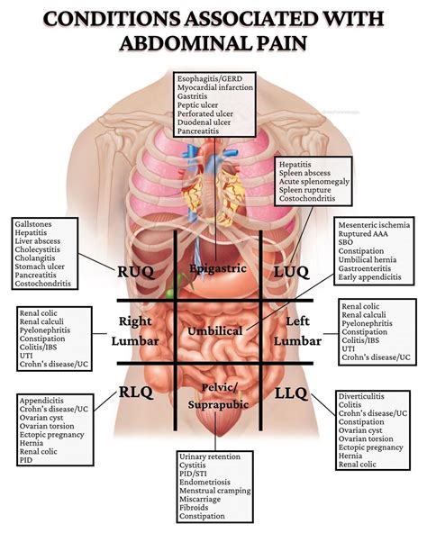 Abdomen Diagram Quadrants