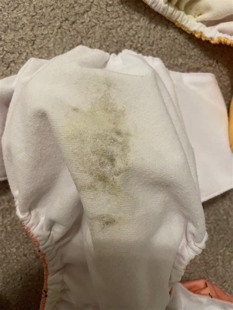 Uric Acid Crystals Diaper Have You Seen This In Your New Baby's