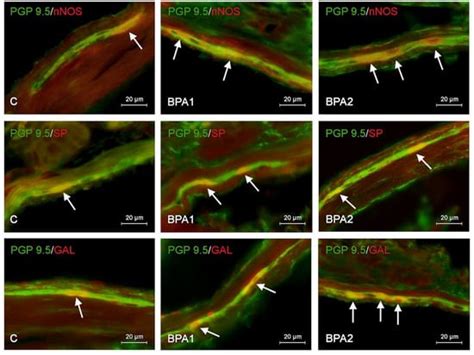 Comparison of the Influence of Bisphenol A and Bisphenol S on the ...