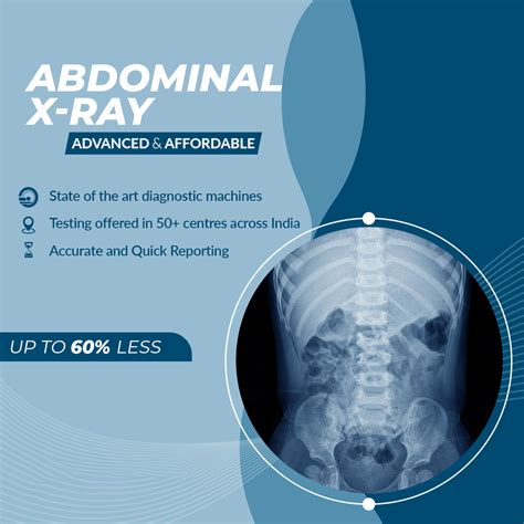 Abdominal X-ray - Aarthi Scans and Labs