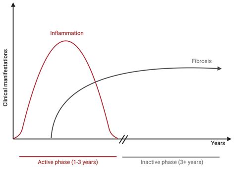 A Comprehensive Review of Thyroid Eye Disease Pathogenesis: From Immune ...