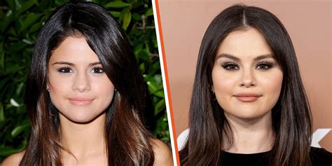Selena Gomez Before And After Drugs