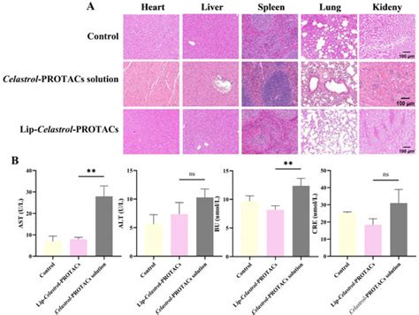 Development and Evaluation of Liposomal Celastrol-PROTACs for Treating ...