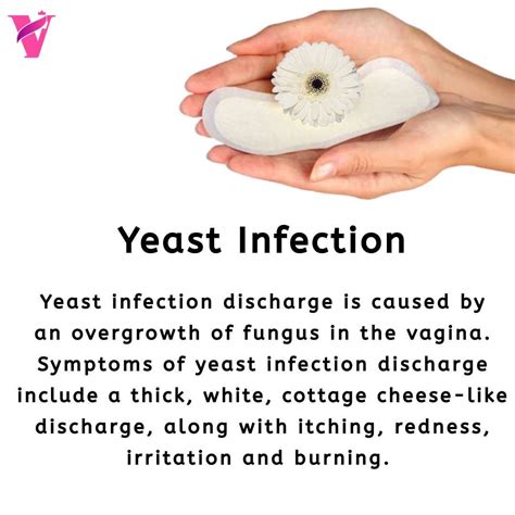 White Vaginal Discharge Yeast Infection