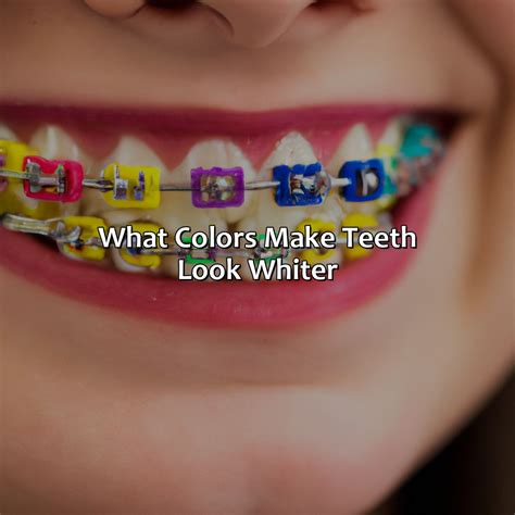 What Braces Color Makes Your Teeth Look Whiter - colorscombo.com