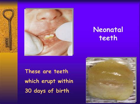 natal neonatal teeth-pedo | PPT