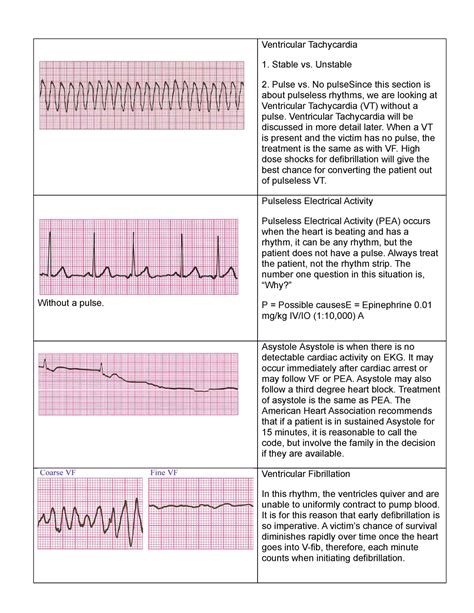 Fine Ventricular Fibrillation Vs Coarse Ventricular Fibrillation
