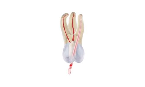 Endodontic root canal obturation | Denstply Sirona IN