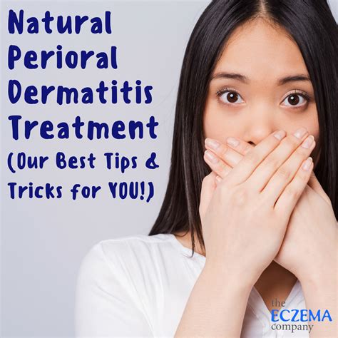 Natural Perioral Dermatitis Treatment (Our Best Tips & Tricks for YOU!)