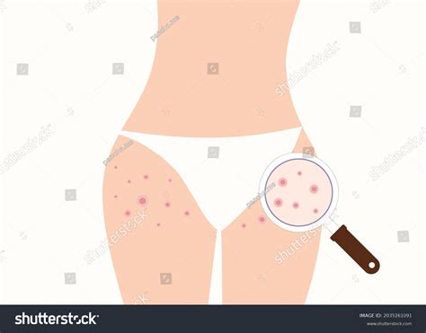 227 Red Spots Ace Images, Stock Photos & Vectors | Shutterstock