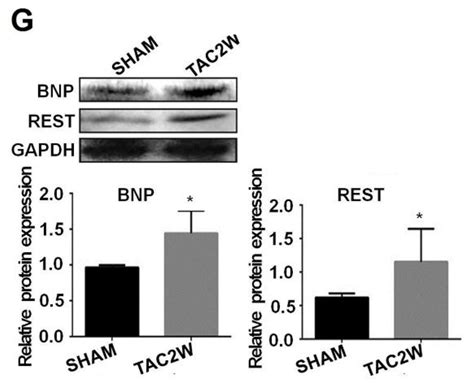 miR-218 Involvement in Cardiomyocyte Hypertrophy Is Likely through ...